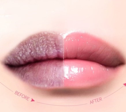 co-nen-tay-te-bao-chet-cho-moi-khong-2